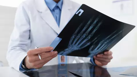 O simplă poză poate depista o boală care scurtează viața cu 10 ani!