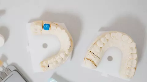 Delta Clinic Dent explică opțiunile moderne de restaurare dentară