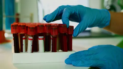 Ghid Synevo pentru menținerea unei stări optime de sănătate