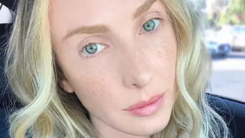 Un model împărtășește inedita ipostază de a fi unită cu sora sa geamănă în uterul mamei sale