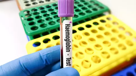 Totul despre hemoglobină: ce este și cum funcționează