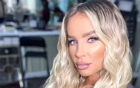 Andreea Bănică și-a făcut o nouă intervenție estetică la față. Cum arată acum