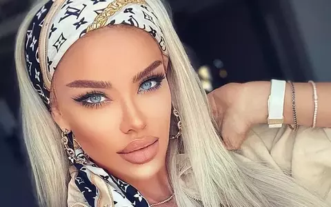 Bianca Drăgușanu, o nouă intervenție estetică rar întâlnită. Ce și-a făcut la mâini: "Frumusețea presupune sacrificii"