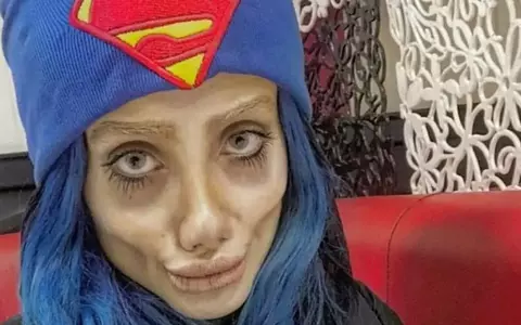 Sahar Tabar, tânăra care a făcut 50 de operaţii estetice ca să semene cu Angelina Jolie, a fost condamnată la 10 ani de închisoare