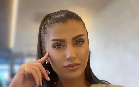 Alina Radi a fost operată de urgență, la ochi! Ce probleme de sănătate are fosta concurentă de la Survivor: "Recuperarea durează o lună și jumătate!"
