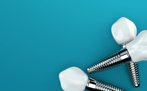 Cum să te pregătești pentru un implant dentar: pași necesari și recomandări ale specialiștilor