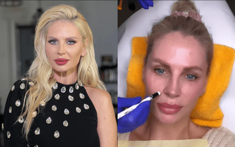 Andreea Bănică și-a făcut o nouă intervenție facială. Cum arată acum: „Frumusețea și tinerețea nu mai sunt atât de greu de întreținut”