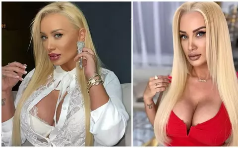 Simona Trașcă și-a făcut operație de mișcorare a sânilor: "Aveam Cupa Mondială, acum am cupa C. Ajungeam la urgențe dacă nu mă operam..."/ Cum o duce pe plan amoros