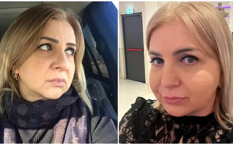 Ce probleme de sănătate are Carmen Șerban la 53 de ani. E nevoită să meargă în cârje: "Am început să plâng când am aflat". Cântăreața a învins cancerul acum 13 ani