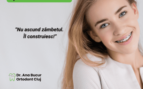 Aparatul dentar metalic – un simbol al transformării asumate