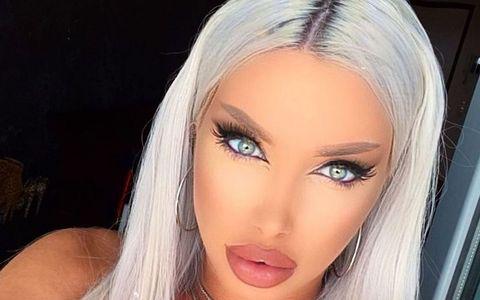 Cum Arată Loredana Chivu După Ce și A Făcut Alte Două Operații Estetice Vedeta Trece Prin Dureri Cumplite