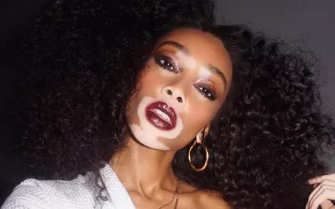 Un alt fel de frumusețe – Au desființat stereotipurile din fashion și showbiz și au devenit vedete!