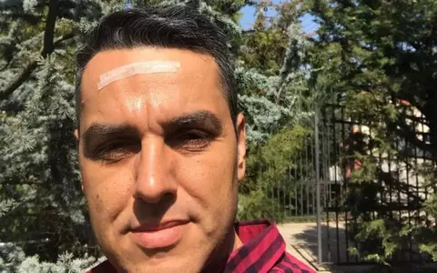 Un invitat i-a spart capul lui Cristi Brancu, în direct: ”Mi-a dat cu paharul în cap”