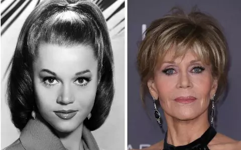 Adina Alberts, chirurg estetician, despre cele 10 intervenții ale lui Jane Fonda