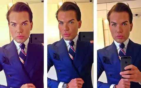 Are 35 de ani și 62 de operații estetice! ”Human Ken” Rodrigo Alves a sărbătorit cu șampanie un nou lifting facial