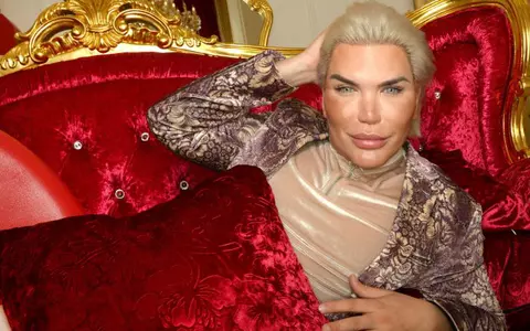 Adina Alberts, despre dezastrul Rodrigo Alves, aka Păpușa Umană Ken: ”Nici nu mai știm dacă e chip uman!”