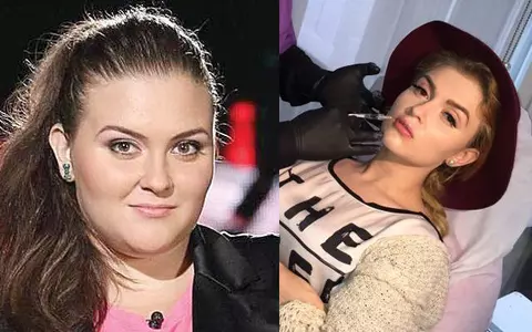 Oana Radu a slăbit 65 de kilograme și a trecut prin 5 operații estetice. Cum arăta înainte să fie celebră. Tranformare incredibilă!