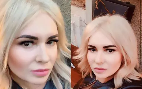 Viorica de la Clejani, încă o intervenţie estetică. Artista este de nerecunoscut, iar fanii au luat foc: “Erai frumoasă rău naturală!”