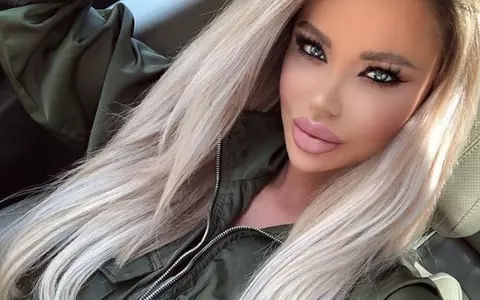Bianca Drăgușanu are probleme de sănătate. Medicul a avertizat-o: e la un pas de o nouă operație