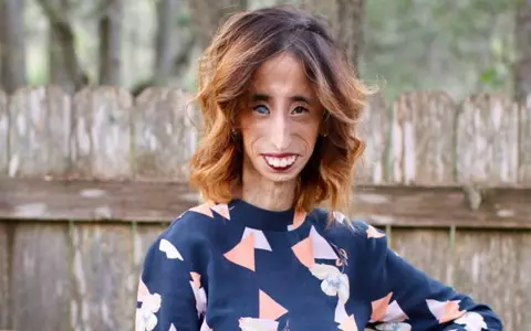 A fost supranumită "cea mai urâtă femeie din lume"! Cum arată Lizzie Velasquez acum! E total schimbată