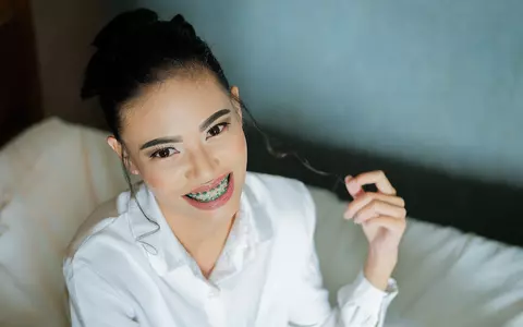 (P) Urmezi un tratament cu aparat dentar? Iata 3 sfaturi pentru asigurarea rezultatului optim!