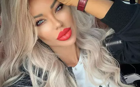 Bianca Drăgușanu, o nouă intervenție chirurgicală. Ce probleme are cu silicoanele după 17 ani