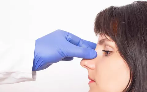 (P) Rinoplastia – moft sau necesitate?