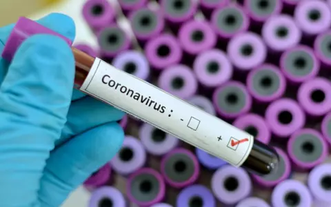 "Pacientul numărul zero", identificat la 60 de km sud de Milano. Cine ar fi adus coronavirusul COVID -19 în Italia