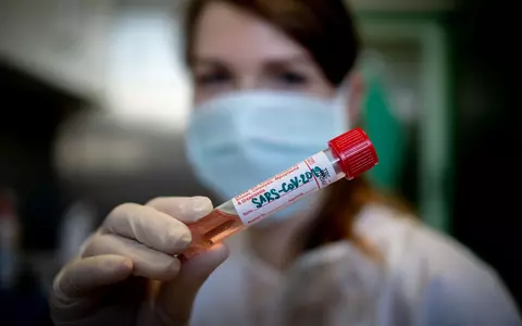 A fost lansat testul online care îți arată dacă ai fost infectat cu coronavirus. Află dacă e cazul să te îngrijorezi!