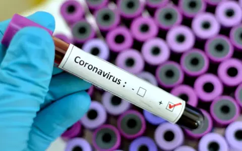 Cum știm dacă ne-am infectat cu coronavirus. Un medic din Wuhan ne învață cum să prevenim boala!