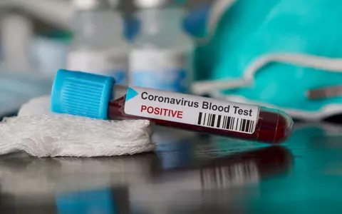 Dosar penal pentru o minoră de 15 ani, infectată cu COVID-19. A mințit autoritățile că n-are rude care sa fi călătorit în străinătate