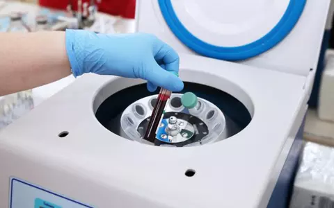 Cum pot dona plasmă persoanele care au avut COVID-19 pentru vindecarea pacienților infectați. Atenție, sunt reguli noi!