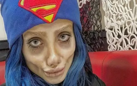 Sahar Tabar, tânăra care a făcut 50 de operaţii estetice ca să semene cu Angelina Jolie, s-a îmbolnăvit de COVID-19 în închisoare. Acum este conectată la ventilator