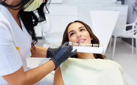 (P) Tot ce trebuie să știm despre ce este albirea dentară și cum putem scăpa de petele dentare prin albire dentară!