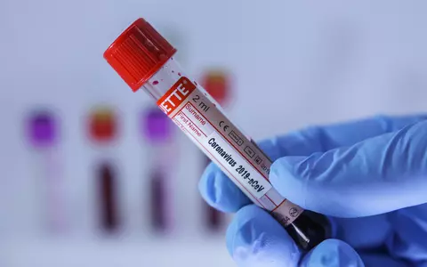 După mai multe întruniri religioase, o comună din Vaslui a devenit focar de coronavirus. 250 de persoane ar putea fi deja infectate