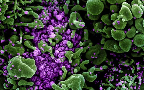 Simptomul de COVID-19 pe care specialiștii nu l-au luat în seamă la început: ”Mai mult de jumătate din cei infectați au ajuns la spital cu probleme digestive”