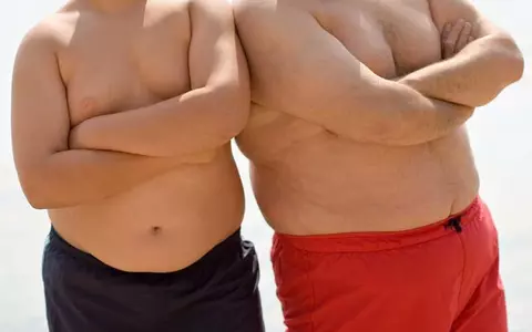 Persoanele obeze riscă să facă forme mult mai grave de COVID-19. Cât de importantă este greutatea în lupta împotriva coronavirusului