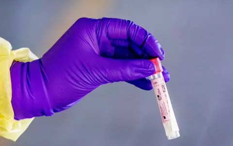 Semnalul de alarmă tras de specialiștii germani. Mănușile pot crește riscul infectării cu COVID-19, în loc să țină la distanță virusul