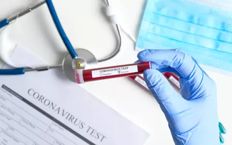 În ce constă formula 0-5-30 despre care medicii italieni susțin că ne poate ţine departe de orice boală, inclusiv COVID-19
