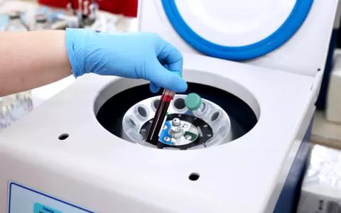 Vești bune din Galați! Ce s-a întâmplat cu primul pacient tratat cu plasmă îmbogăţită cu anticorpi de la două persoane vindecate de COVID-19. Tratamentul a dat rezultate!