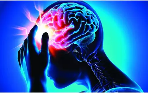 Medicii atenționează: “În caz de AVC, nu stați acasă! Un minut pierdut înseamnă două milioane de neuroni pierduți!”. Când trebuie să chemi ambulanța
