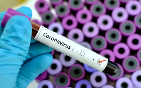 Experții au descoperit că imunitatea la coronavirus e "alarmant de mică"! În cât timp te poți reinfecta, după vindecare