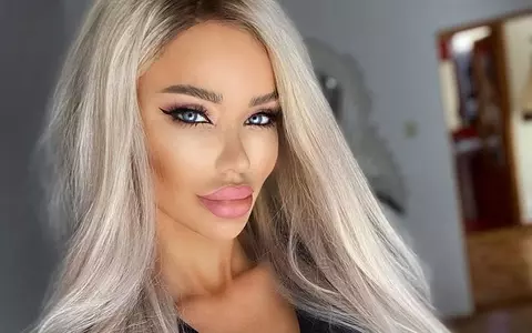 Bianca Drăgușanu și-a mărit, din nou, buzele. Cum arată acum: unii spun că îi stă bine, alții că a exagerat