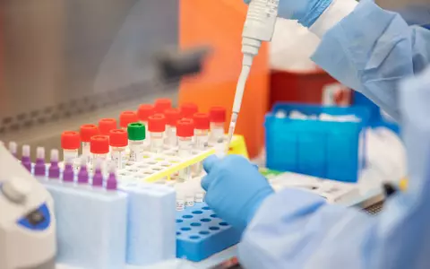 Motivul pentru care testele COVID-19 pot da rezultate false: totul depinde de numărul de zile care au trecut de la infectare