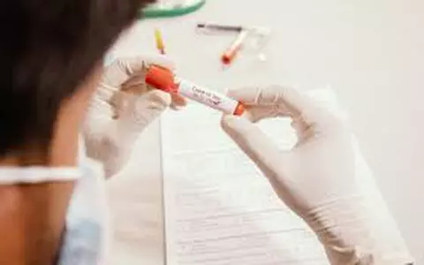 COVID-19 vine cu noi simptome atipice. Două dintre acestea sunt asociate altor boli și nasc confuzii în rândul pacienților