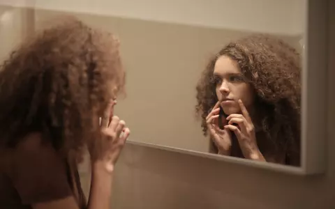 Cinci cauze surprinzătoare ale acneei la adulţi