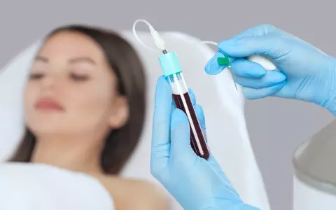Ce este Terapia Vampir (PRP), tratamentul de ultimă generație împotriva ridurilor și a căderii părului