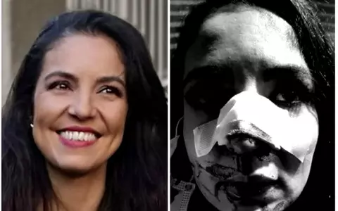 Cristina Joia a rememorat momentul în care a fost desfigurată în bătaie: "Mi-au legat mâinile, simțeam că mă sufoc!"