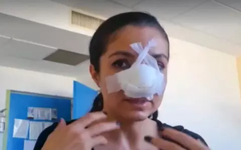 Cristina Joia, de la Visuri la Cheie, a făcut a doua operație la nas, după ce a fost bătută: „Intervenţia a durat cinci ore”