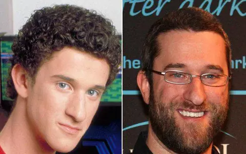 Dustin Diamond, Screech din Salvați de clopoțel, diagnosticat cu cancer în stadiul 4!
